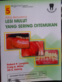 Atlas Berwarna Lesi Mulut Yang Sering Ditemukan, Ed. 5