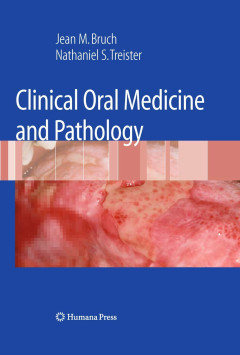 1 cover