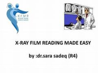 EBOOK FKG. X-Ray Film Reading Made Easy
