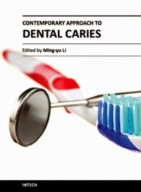 Ebook FKG. Contemporary Approach to Dental Caries