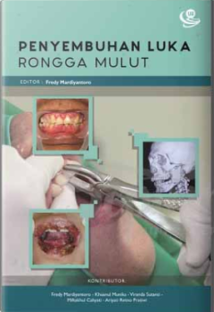 1 cover
