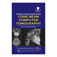 PRINSIP DASAR INTERPRETASI CONE BEAM COUMPUTED TOMOGRAPHY (CBCT)