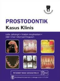 PROSTODONTIK Kasus Klinis