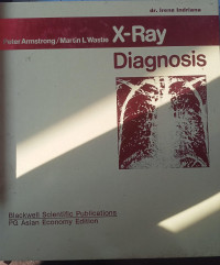 X-RAY DIAGNOSIS