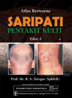 1 cover